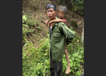 貓晶片植入會痛嗎?主人經驗與安全提醒!