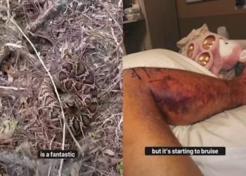 屏東男子當街「遛蛇」被蟒蛇纏頸勒倒!三度遭愛蟒咬傷送醫